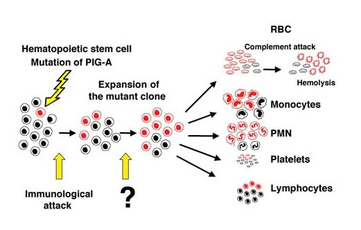 PHN En förvärvad sjukdom i hematopoetiska stamceller Somatisk mutation i en