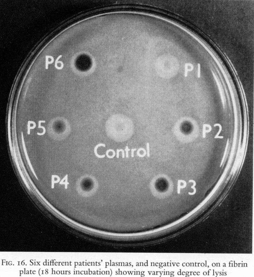 Fibrinplattemetoden (Astrup & Mullertz 1952) Fibrinogen koagulerat i en petriskål.