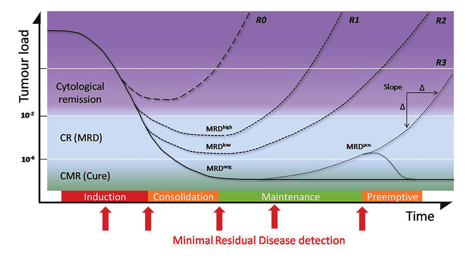 Tumor load is one of the best