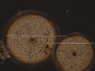 fragilissimus, överst till höger den solitära kiselalgen Coscinodicus