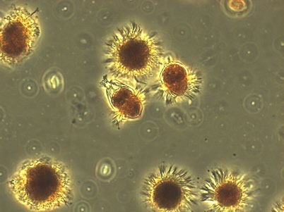 Mesodinium rubrum och nederst till höger den potentiellt fisktoxiska