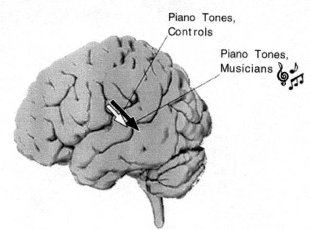 pericalcarine cortex