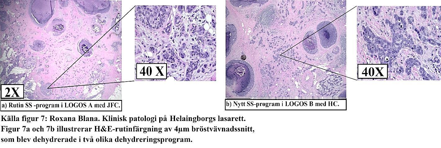 Detta beroende på att infärgningarna misslyckades eftersom samtliga snitt delvis var tjocka, ett faktum som ledde till partiell överfärgning.