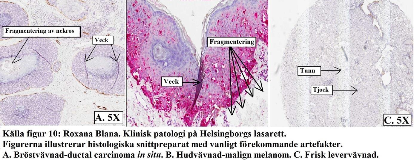 Artefakter som vanligt förekom under arbetens gång var fragmentering, veck och ojämhet i tjocklek.