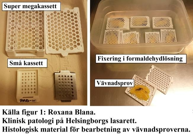 Syftet med utskärningen är att högst 5 mm tjocka representativa vävnadsskivor skärs ut enligt specifika metodbeskrivningar och läggs i lämpliga kassetter (Figur1).