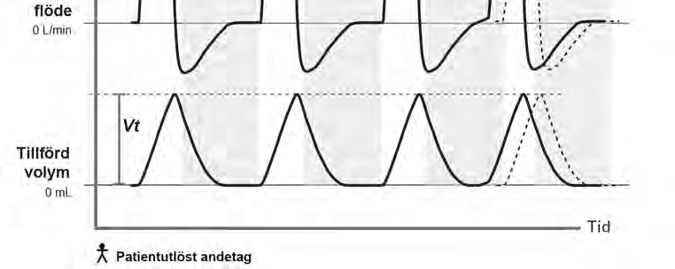 P(A)CV-funktion assisterad tryckstyrd ventilation P(A)CV är en funktion för måltrycksventilation som administrerar tryckstyrda obligatoriska andetag: - Inandning kan antingen initieras genom