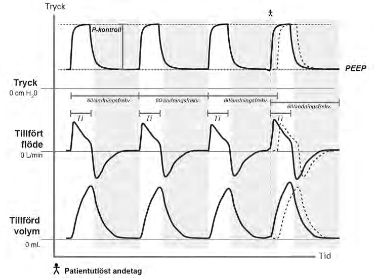 Ventilationsfunktioner Parameter Triggertyp Trigger Inställning Flöde/Tryck Endast tillgänglig för dubbla kretsar.