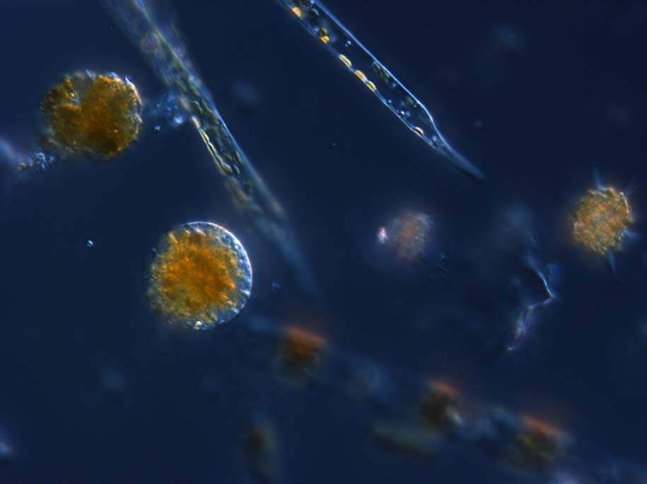 1) Proboscia alata (Fig.2) the Silicoflagellates Dictyocha speculum and D. fibula (Fig.2) were numerous in this area.