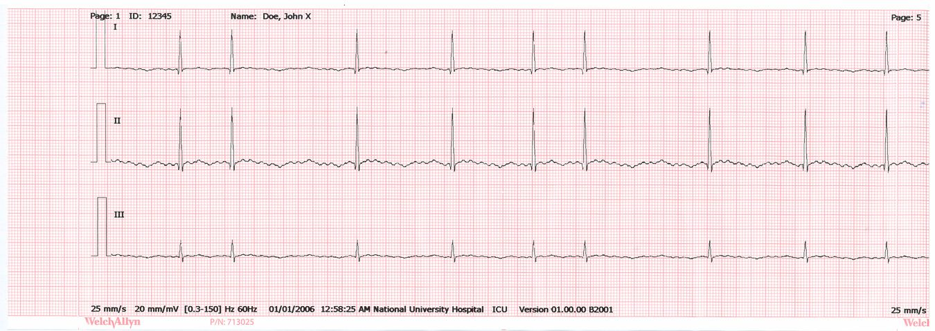 I CP 50 Plus-modeller kan automatiska EKG:n även skickas till en Welch Allyn CardioPerfect-arbetsstation.