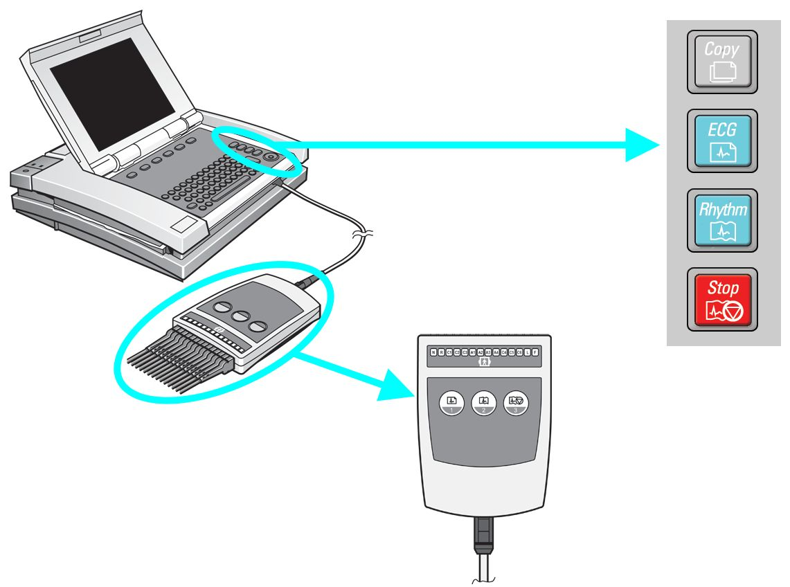 3. Tryck på funktionsknappen för att förvärva ett EKG För att förvärva en 12-elektroders EKG-registrering, tryck på elektrokardiografens funktionstangent som är dedikerad för detta ändamål.