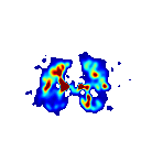 Detta COS2-filter har sin noll-genomgång vid den maximala frekvensen 1/2Δ. När det gäller butterworth-filtret måste vi veta samplingsavståndet Δ.