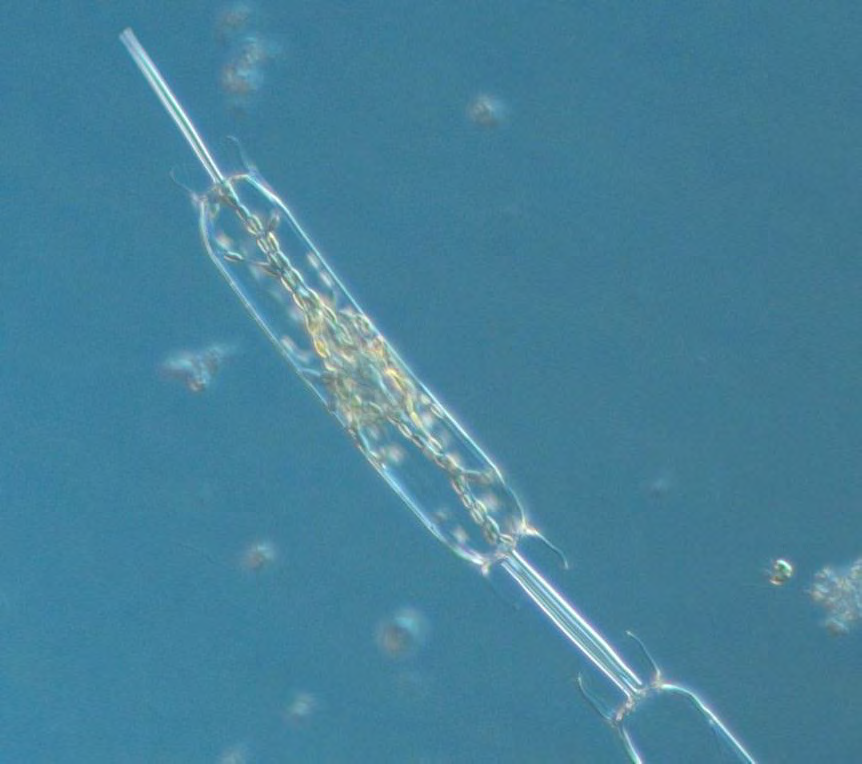 Kiselalgen Skeletonema marinoi hade ökat kraftigt i antal igen jämfört med aprilproverna, och dominerade i maj både i antal celler och i mängden biovolym.