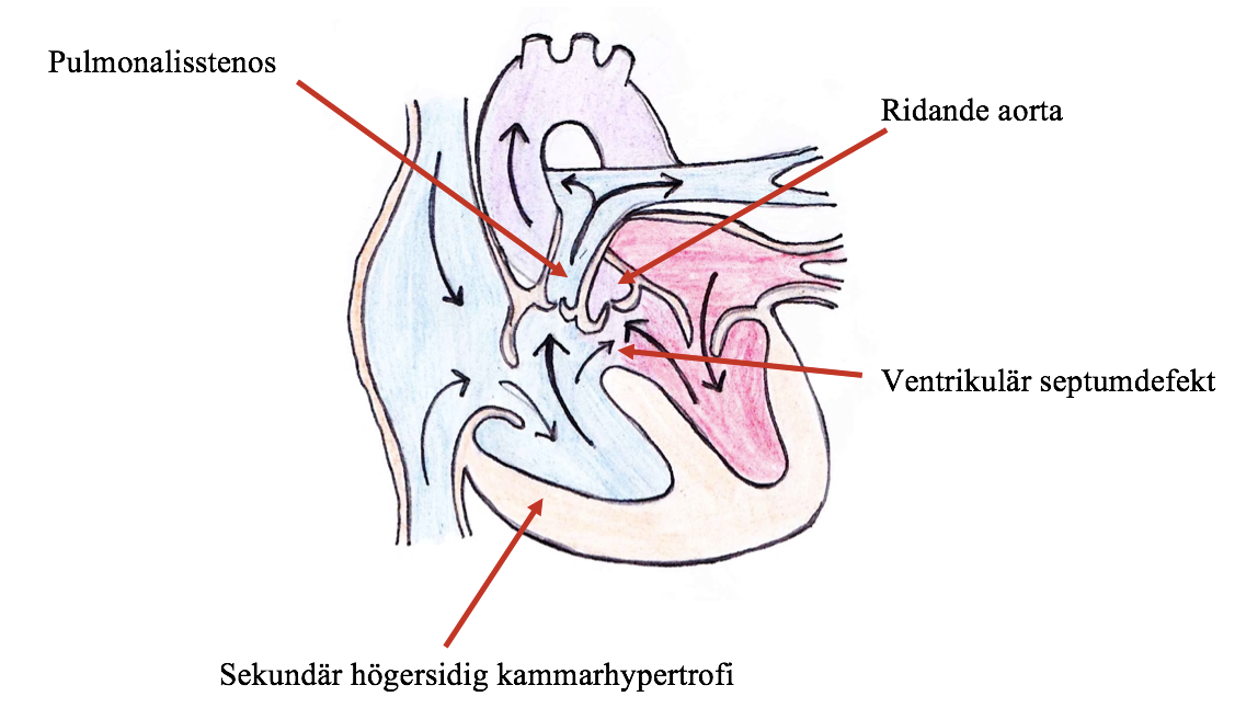 mellan olika hundraser (Tidholm, 1997; Schrope, 2015). En nyligen skriven rapport från USA visar att prevalensen för medfödda hjärtfel är lägre än man tidigare trott.