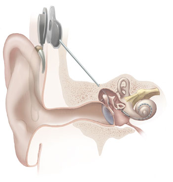 psykologiskt perspektiv Talperception Bottom up