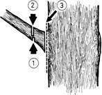 sand, stenar, spikar eller annat. Främmande föremål kan medföra farliga bakslag. Löst trävirke måste spännas fast ordentligt, t.ex. i sågbock. Lägg inte foten mot virket som stöd.