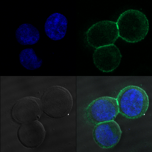 -HER-2 Subcellular