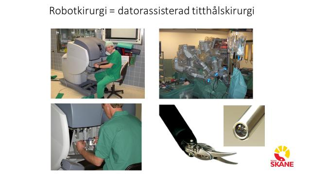 Sammanfattning Skånes universitetssjukhus har bedrivit och utvecklat robotkirurgisk verksamhet sedan 2005.