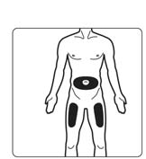 injektionspennan visuellt Ta ut den förfyllda injektionspennan från kylskåpet. Skaka inte. Undersök visuellt den förfyllda injektionspennan och även läkemedlet genom att titta i fönstret.