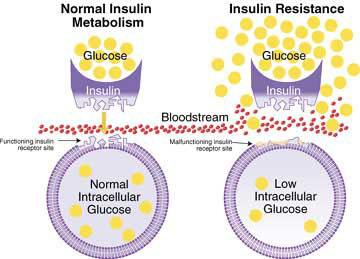 Figur 1. Demonstration av en normal insulinmetabolism samt insulinresistens.