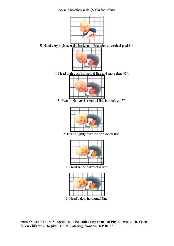 Function Scale (MFS) Bedömningsskala