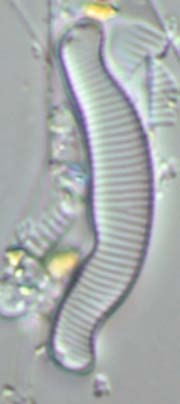 Most teratological forms under maximum heavy metal concentration Metals measured: Cu, Zn, Cd, Pb, Cr, Ni, As, Co, V