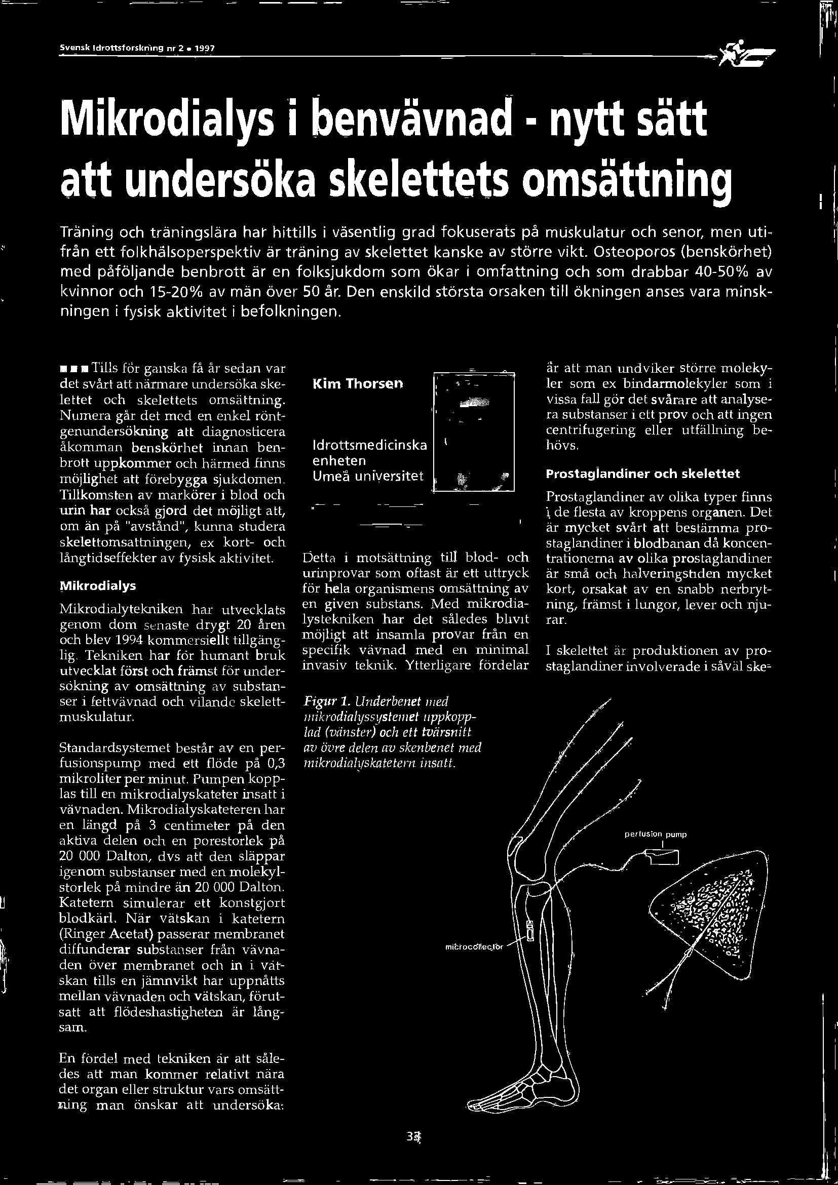 Osteoporos (benskörhet) med påföljande benbrott är en folksjukdom som ökar i omfattning och som drabbar 40-50% av kvinnor och 15-20% av män över 50 år.