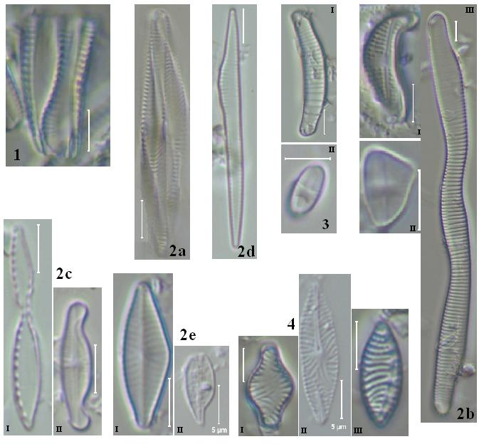 Figur 4. 1. Delning (Rhoicosphenia, C6). 2a. Vriden/böjd (Navicula, E21.) 2b. Helt fel form (I. Amphora, I28, II. Achnanthes minutissima, E21. III. Eunotia, 314). 2c. Indrag (I.Nitzschia, 316. II. Achnanthes, 314).