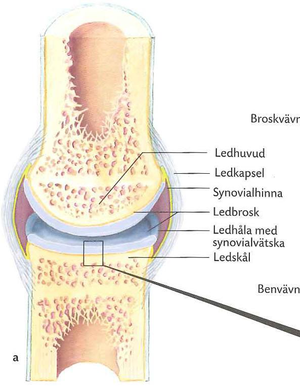 Synovialled Ledhuvud med ledbrosk (brosk = chondros) Ledpanna med ledbrosk Broskskiva disk, menisk Synovialmembran omger leden, synovialvätska ledvätska minskar friktion förser brosket med näring