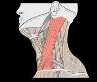 m. sternocleidomastoideus Bröstbenet till