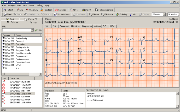 Vy Parametrar Tolkning 4.1 Visa och ändra EKG-information Informationsfönstret ger dig alla typer av information om det EKG som för tillfället visas.