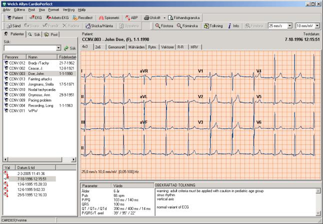 5. Tolka EKG När du visar ett EKG visas tolkningen i det nedre högra hörnet av arbetsytan.