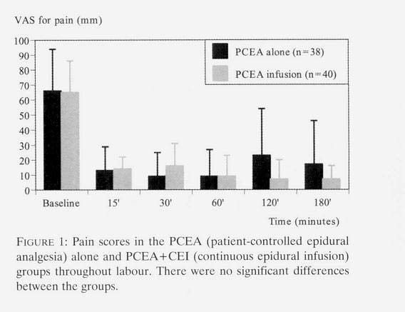 Patient-controlled Epidural Analgesia Following Combined Spinal-epidural Analgesia in Labour: the Effects