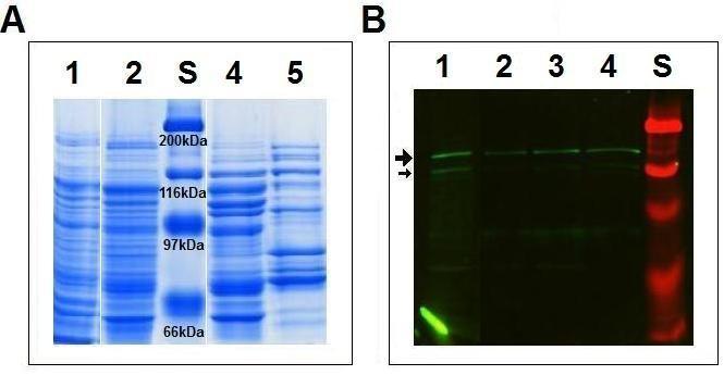 proteinmönstret hos rålysatet jämförs med HIC-poolens proteinmönster. Genom att studera figur 4B kan man konstatera att det fanns TPPII i alla brunnar.