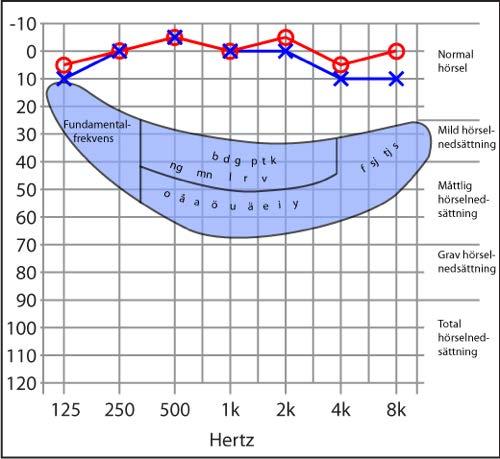 Talfrekvenser & hörapparat Frekvenserna visar var talljuden har mest