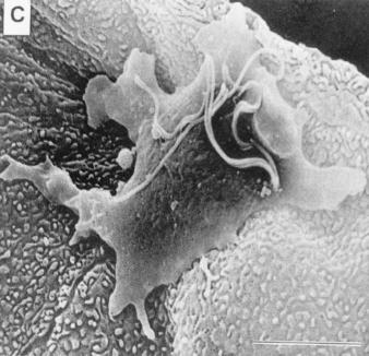 Trichomonader hur gör de oss sjuka?