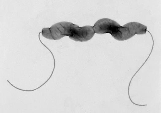 BAKGRUND CAMPYLOBACTER I SVERIGE Campylobacter är en vanlig zoonotisk bakterie över hela världen och den finns hos både djur och människor I Sverige har vi en årlig övervakning av campylobacter på