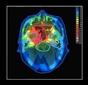 Medicinsk Visualisering,