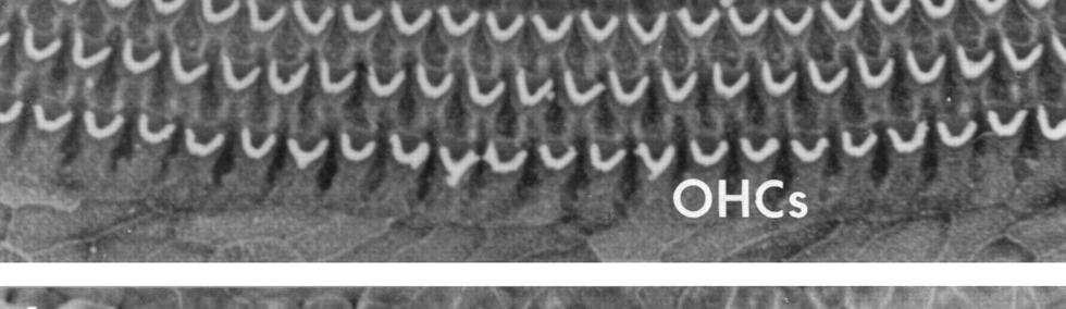 eardrum and the oval window Abnormalities at the