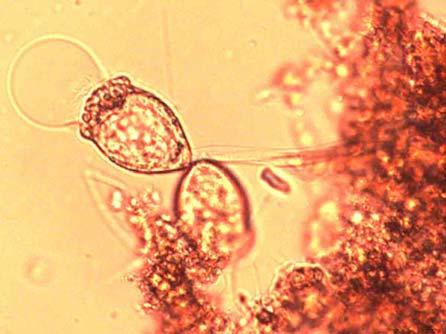 På den högra bilden syns klockdjur (Vorticella) som är en typ av ciliater och indikerar goda slamegenskaper (Henze et al 1995). 4.3.