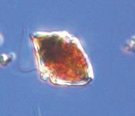 Bornholm Basin BY, 17 th of September The diatom Chaetoceros impressus was abundant, as well as the dinoflagellates Heterocapsa triquetra and Prorocentrum minimum* and the cyanobacterium