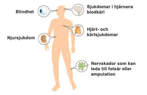 7. Sena komplikationer Diabetes med långvarigt höga blodsockervärden orsakar skador på olika strukturer och organ i kroppen.