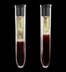 study hydroxycarbamide vs anagrelide