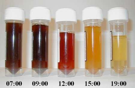 Other blood group incompatibility (RhC, HDFN också känt som erytroblastosis fetalis Rhesus D hemolytisk sjukdom ABO hemolytisk sjukdom Anti-Kell hemolytic disease of the newborn Rhesus c hemolytic