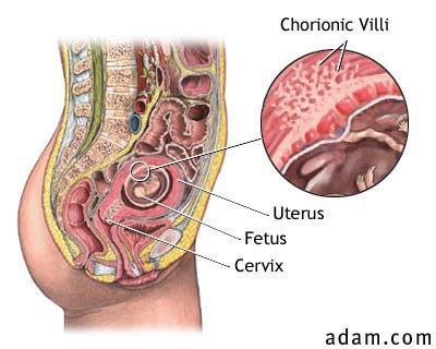 Provtagning Plasma versus amnion/cvs