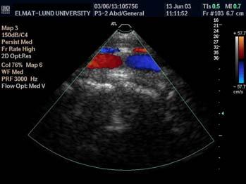 Fasskiftsestimering Angle dependence in color Doppler Im Q(i) dφ φi