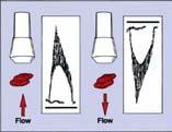 Maxhastigheten begränsas av prf ø Artery ø Aliasing Velocity profile, v Observation region in overlap of beams