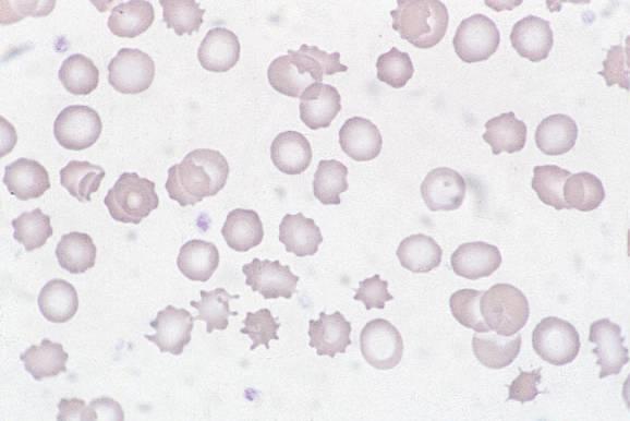 Ekinocyter ekino: sjöborre (grekiska) Kännetecken Små, korta, trubbiga utskott jämnt fördelade över cellen I tidig fas är cellen diskformad