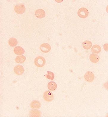 Kännetecken 1-3 μm eller större. Storleken beror på oxideringshastigheten av hemoglobin. Om den är snabb, som vid G-6-PDbrist är kropparna små och talrika.