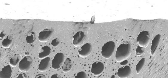 UV 100 µm