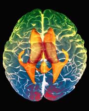 Split-brain Hjärnhalvorna är specialiserade när det gäller vissa kognitiva förmågor.
